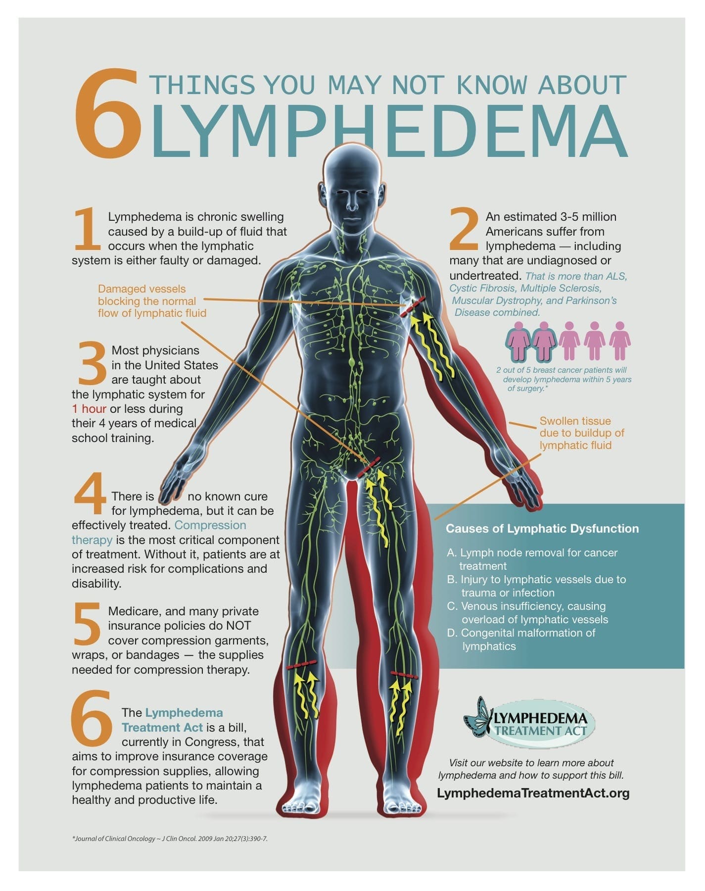 Get Set For Lymphedema Awareness Month In March